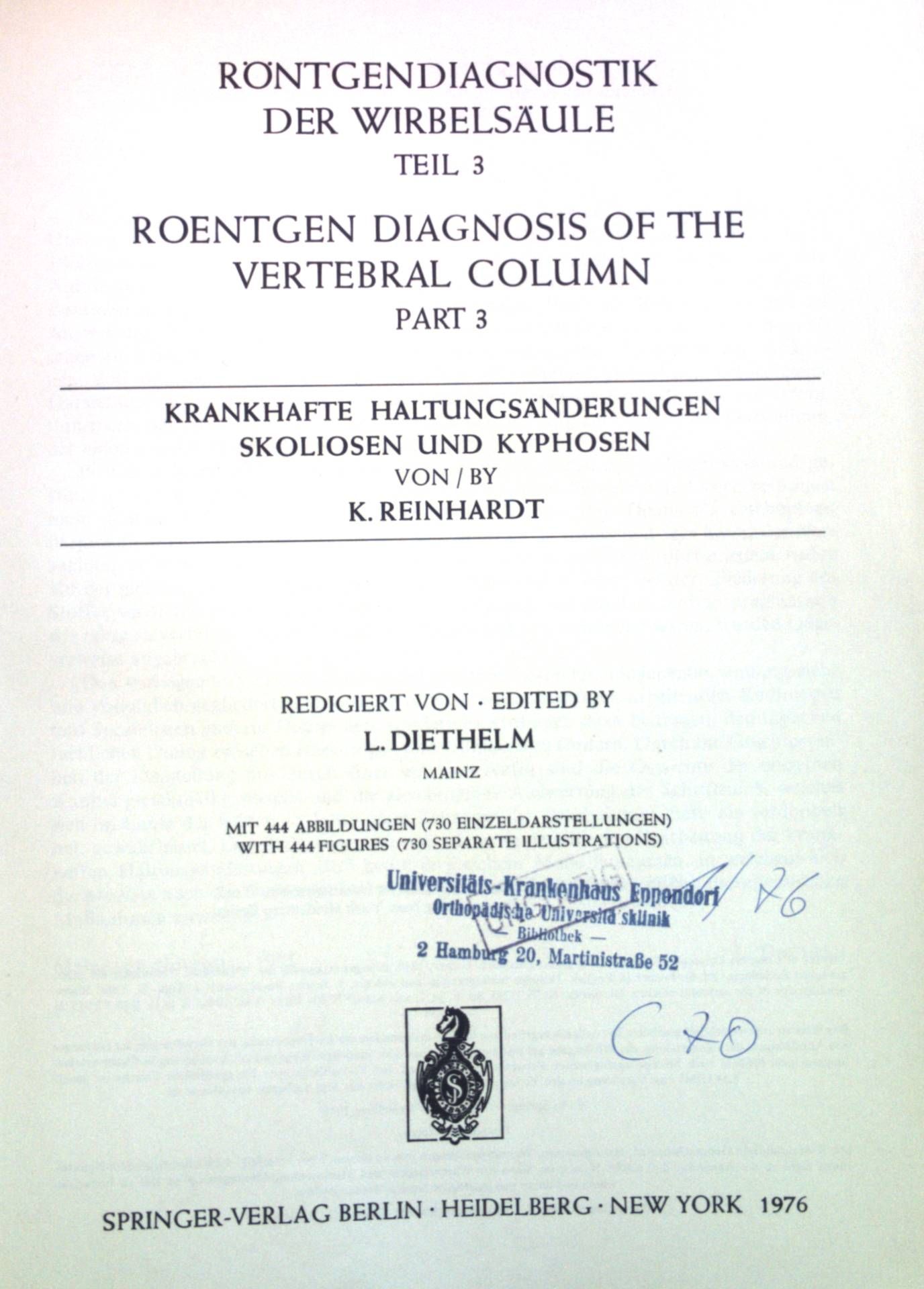 Röntgendiagnostik der Wirbelsäule: Krankhafte Haltungsänderungen Skoliosen und Kyphosen, Teil 3
