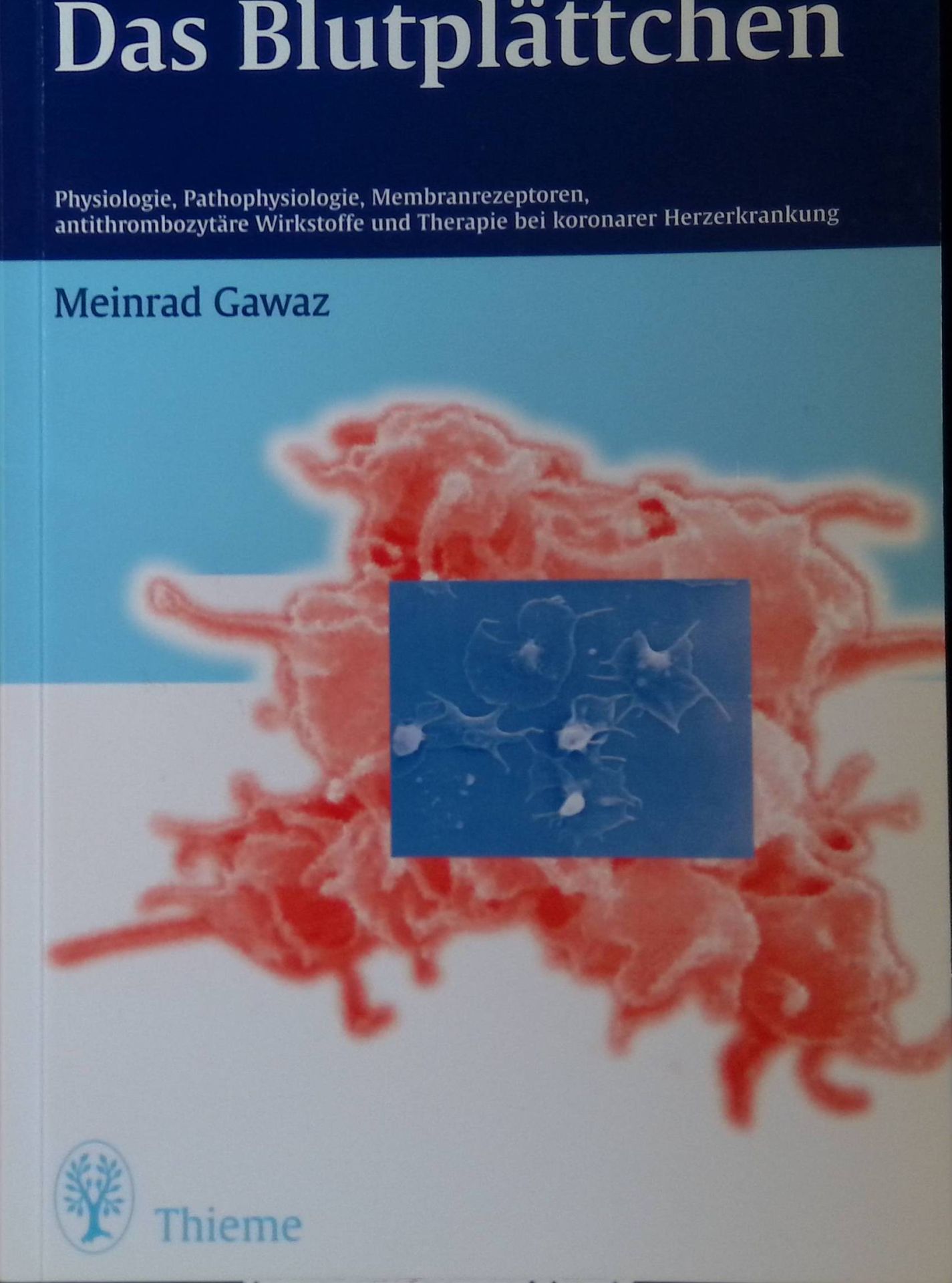Das Blutplättchen : Physiologie, Pathophysiologie, Membranrezeptoren, antithrombozytäre Wirkstoffe und antithrombozytäre Therapie bei koronarer Herzerkrankung - 31 Tabellen