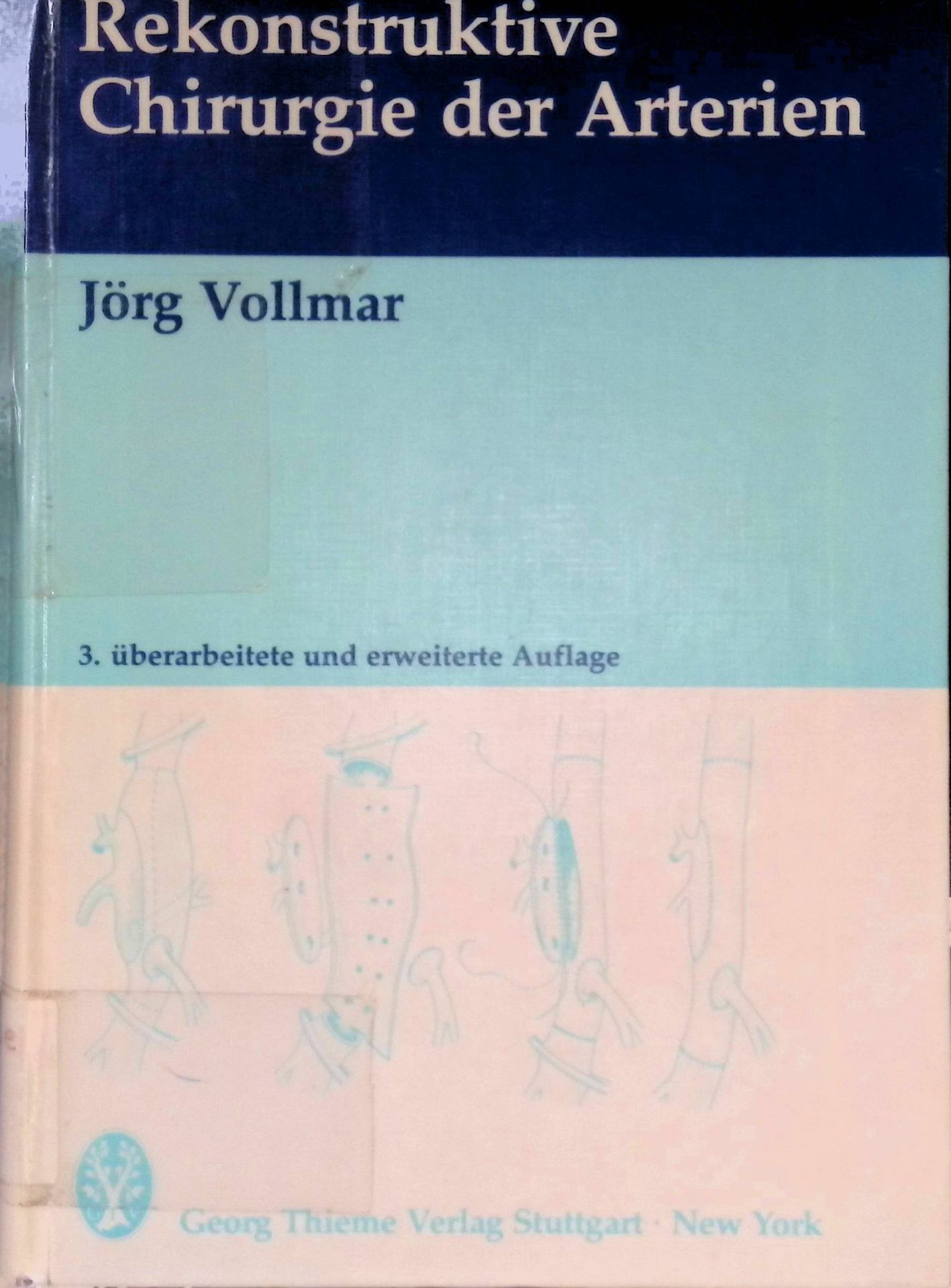 Rekonstruktive Chirurgie der Arterien
